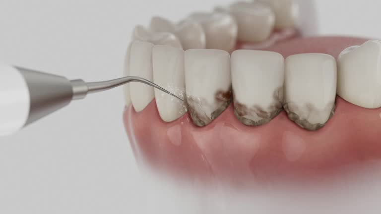 Reliable Dental contractor in Berkeley, CA by Dentist Open Now
